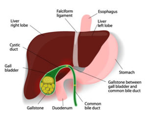 New Jersey Gall Bladder Doctors